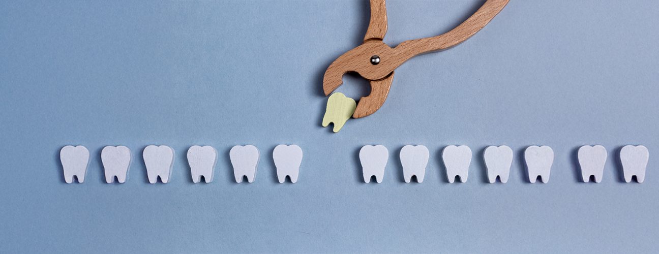 How to Prepare for Your Dental Extraction Appointment