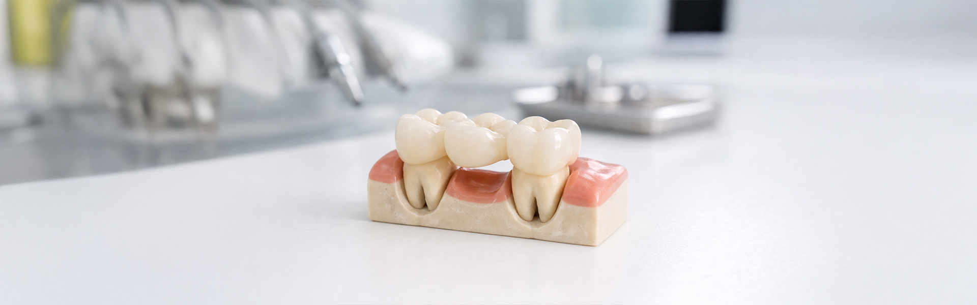 How Digital Dentistry Improves the Fit and Comfort of Dental Bridges