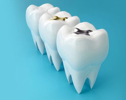 What Happens If You Ignore a Cavity That Needs a Filling?